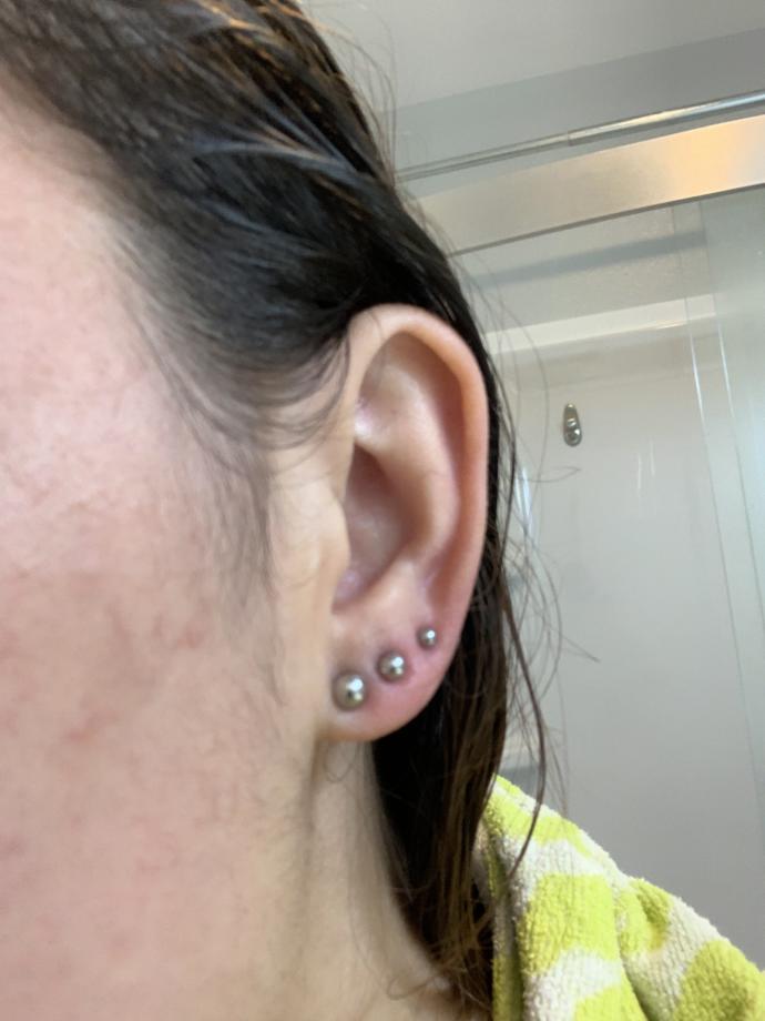 Two days into an ear piercing. do they look infected ...