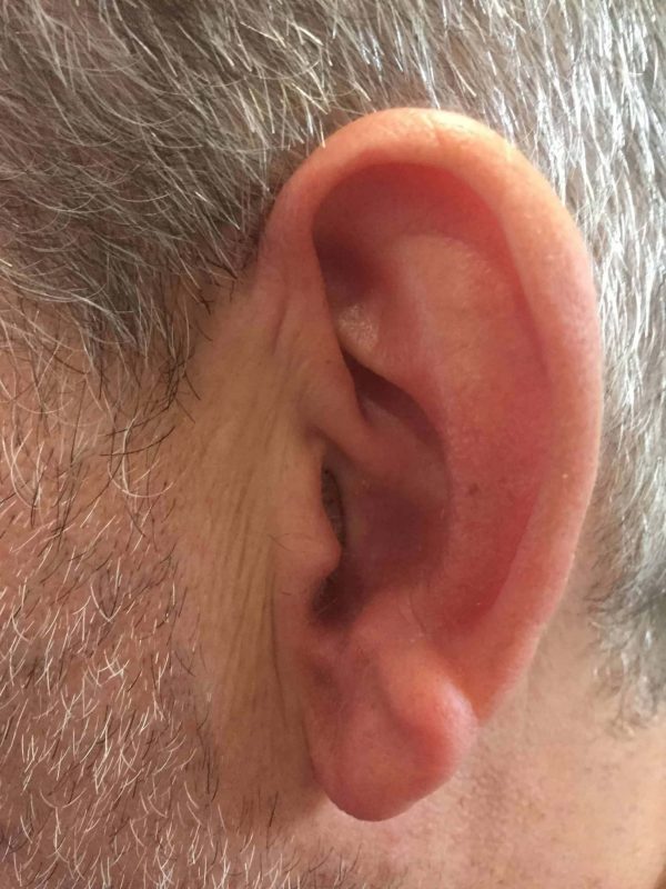 What do hearing aids look like?