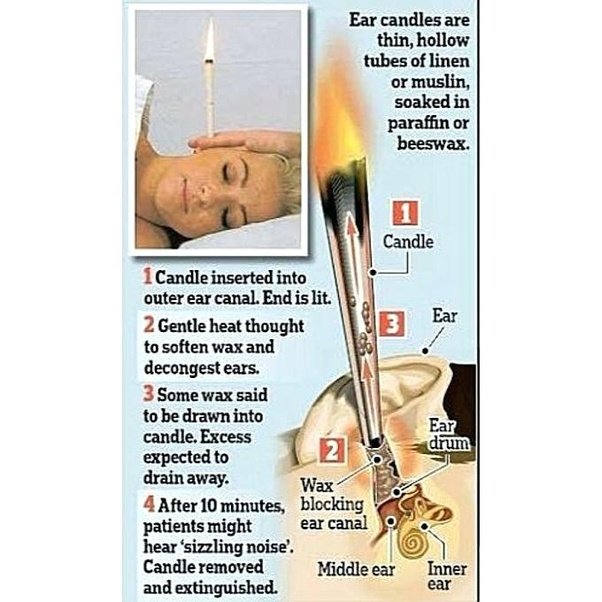 What is ear candles theraphy?