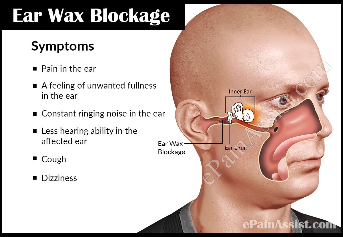 What Is Ear Wax and Why Do Some of Us Have Too Much or Too Little ...